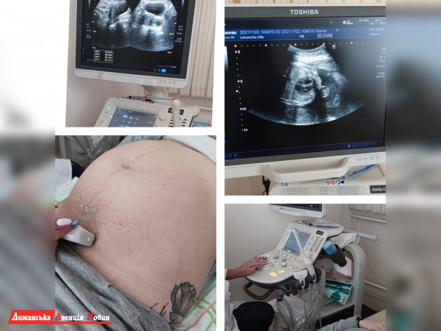 В КНП «Доброславская МБИЛ» можно сделать скрининговое УЗИ во время беременности